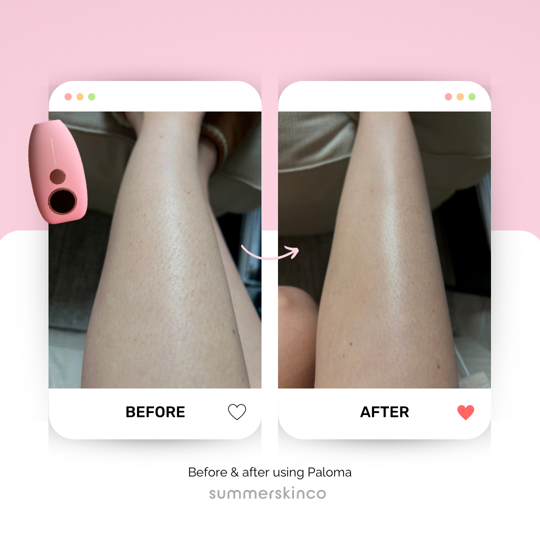 summerskinco 'Paloma' LIMITED TIKTOK DEAL